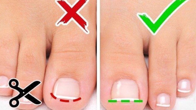 Xử lý móng chân bị hư an toàn 1