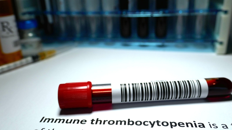 Xuất huyết giảm tiểu cầu là một rối loạn huyết học xảy ra khi số lượng tiểu cầu trong máu thấp hơn mức bình thường