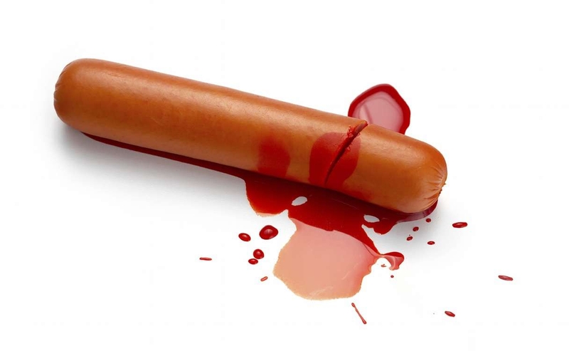 Xuất tinh ra máu: Triệu chứng, nguyên nhân và cách điều trị 2