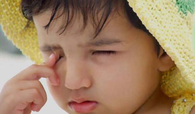 Dấu hiệu xước giác mạc ở trẻ em