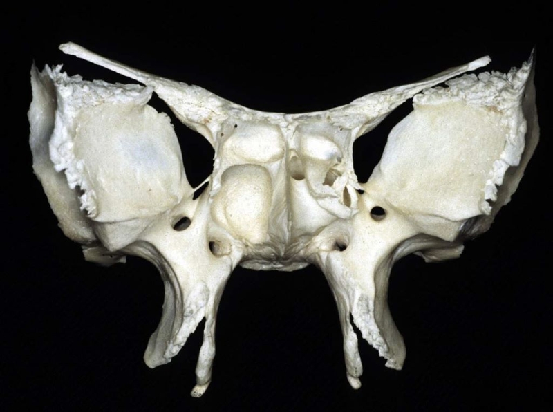 Xương bướm ở đâu? Chức năng xoang bướm và nguyên nhân gây viêm xoang bạn nên biết 1