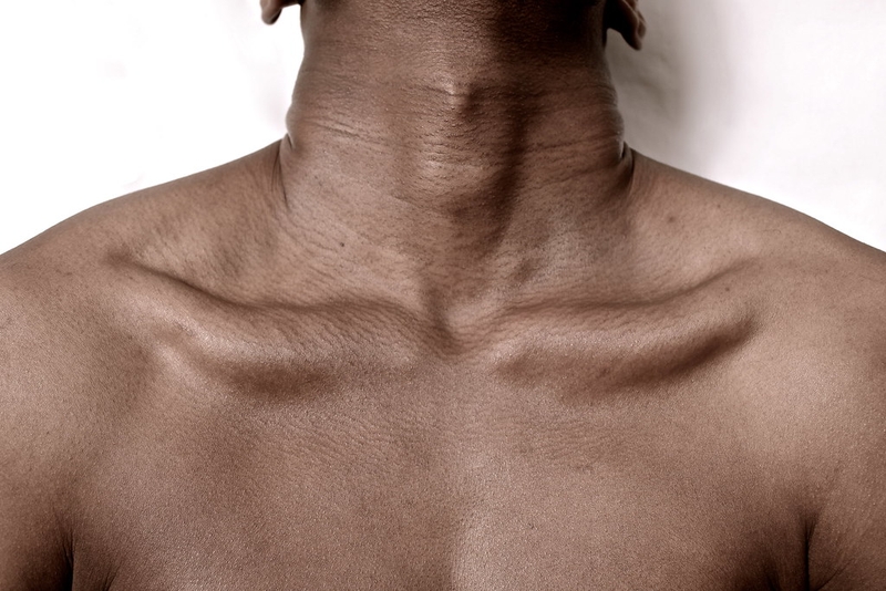 Xương đòn là gì? Xương đòn có chức năng gì? 1