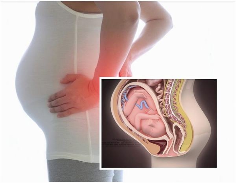 Nguyên nhân, triệu chứng và cách điều trị đau xương mu khớp háng 2