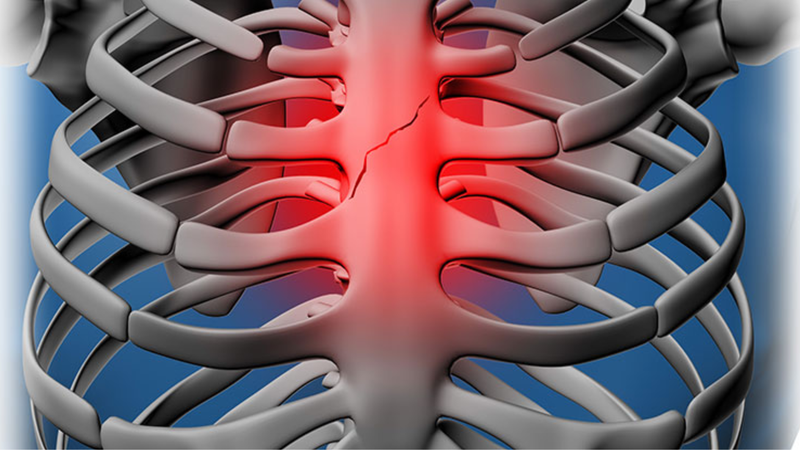 Xương ức là gì? Các bệnh lý liên quan đến xương ức 3