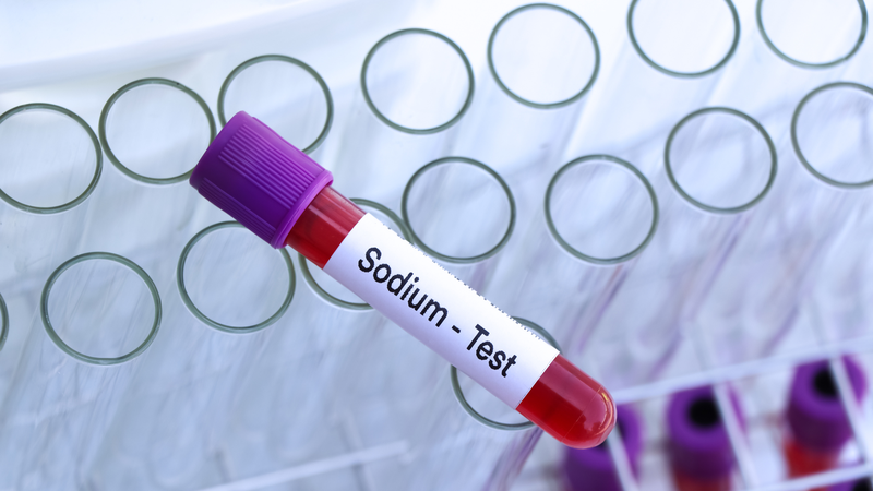 Rối loạn natri máu có thể phát hiện thông qua điện giải đồ