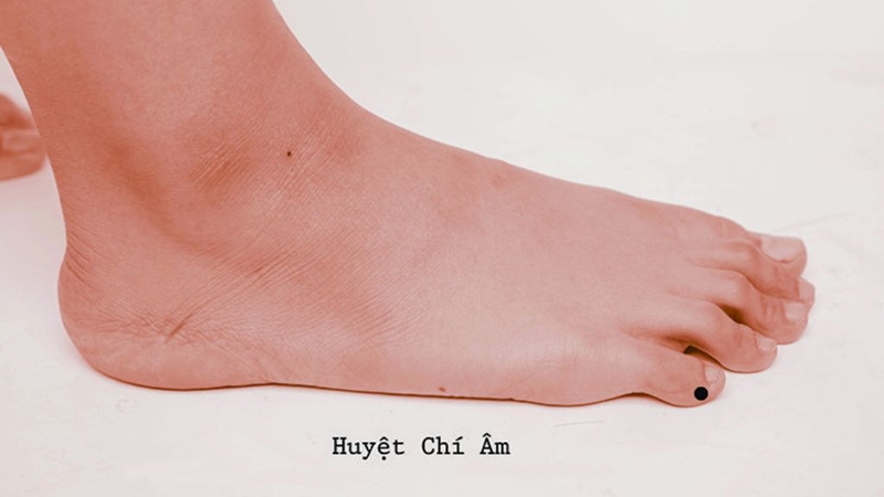 Y học cổ truyền: Huyệt chí âm và những điều cần biết 2
