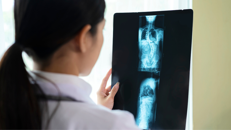 Y học hạt nhân là gì? 1