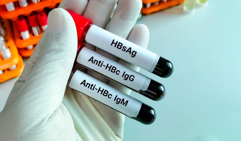 Ý nghĩa của những xét nghiệm viêm gan B phổ biến 1