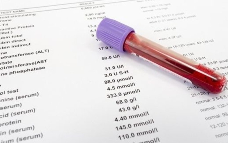 y-nghia-lam-sang-ket-qua-chi-so-sat-trong-mau 2.jpg