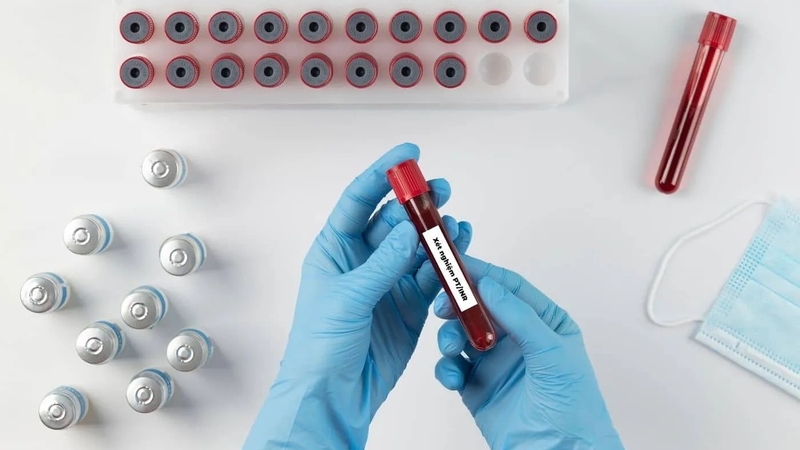 y-nghia-lam-sang-ket-qua-xet-nghiem-chi-so-inr-2 Cropped.jpg