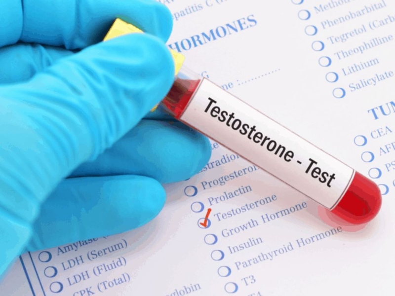 Mãn dục nam sớm: Yếu tố nguy cơ, triệu chứng và cách điều trị 4