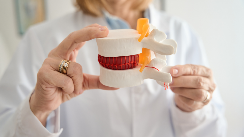 Thoát vị đĩa đệm là tình trạng phổ biến liên quan đến cột sống