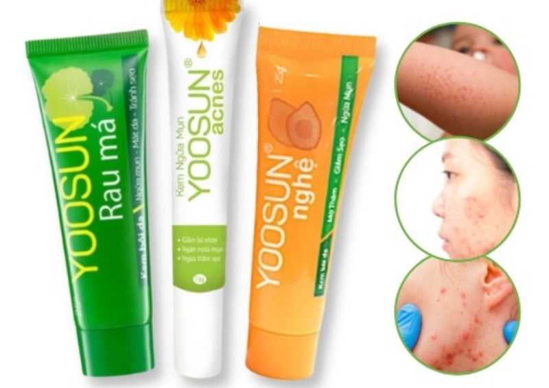Yoosun rau má và Yoosun Acnes cái nào tốt hơn? 1