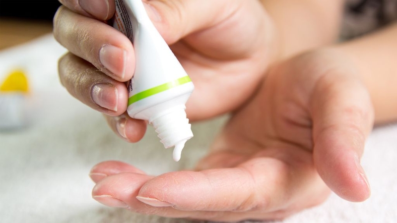 Zona ở bụng: Cách điều trị và chăm sóc 2