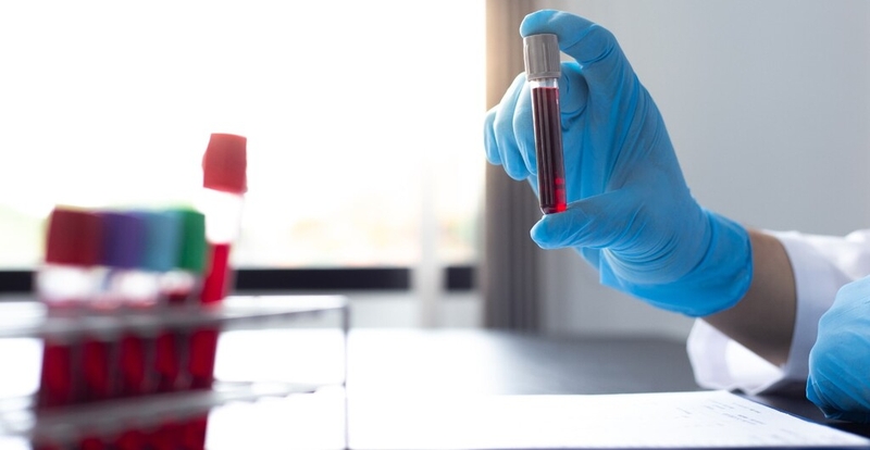 Zona thần kinh ở đầu: Nguyên nhân, triệu chứng, chẩn đoán, điều trị và phòng ngừa 3