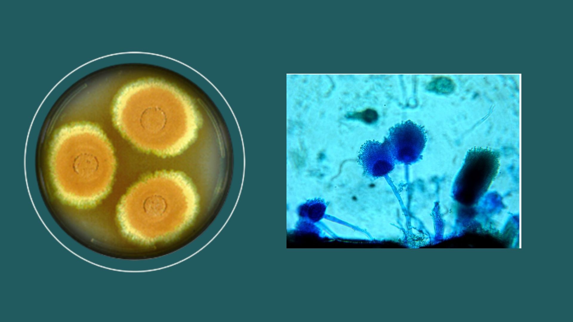 Hình ảnh Aspergillus terreus