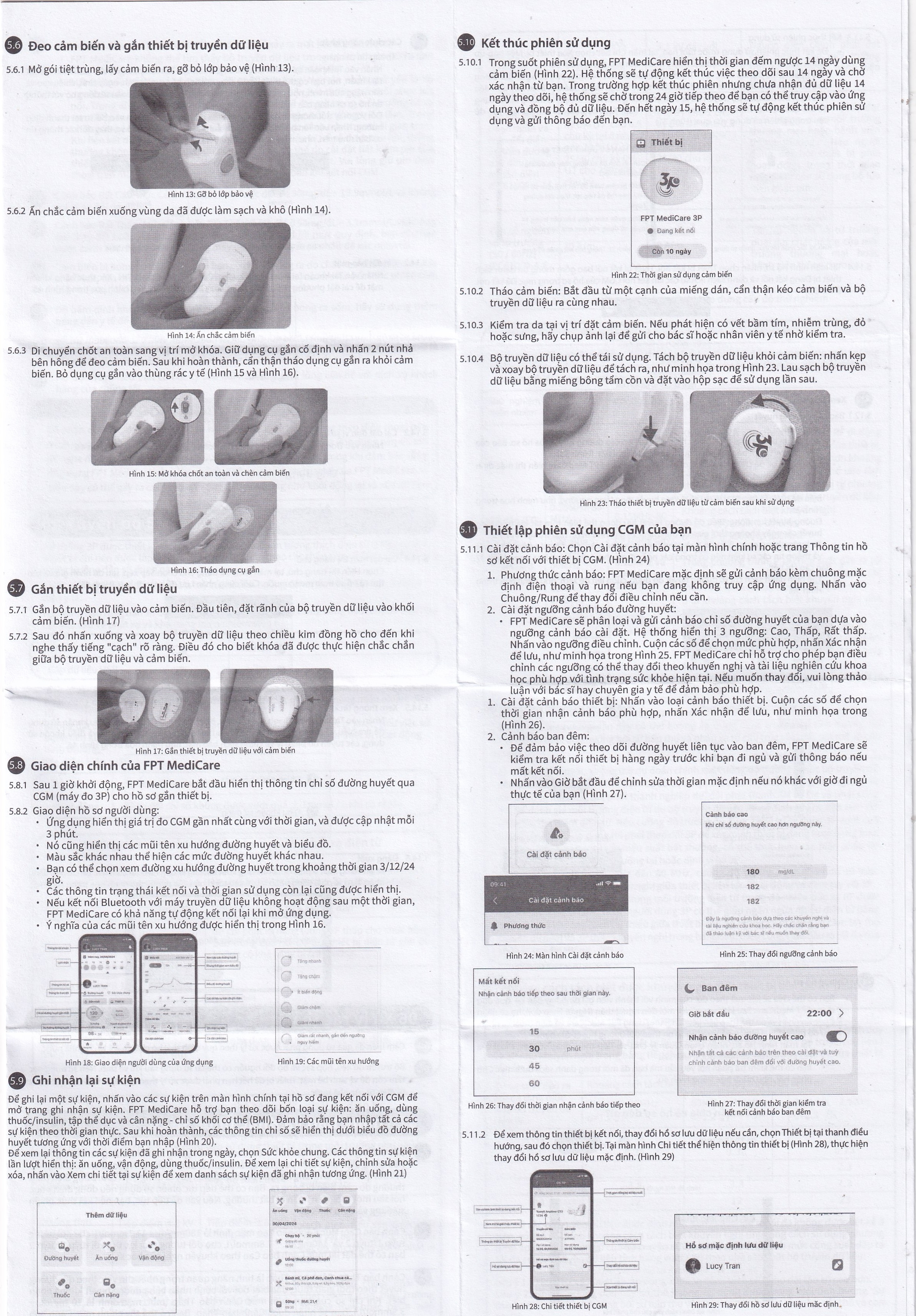 Hình ảnh Bộ cảm biến máy đo đường huyết liên tục 3P cho bệnh nhân mắc bệnh tiểu đường
