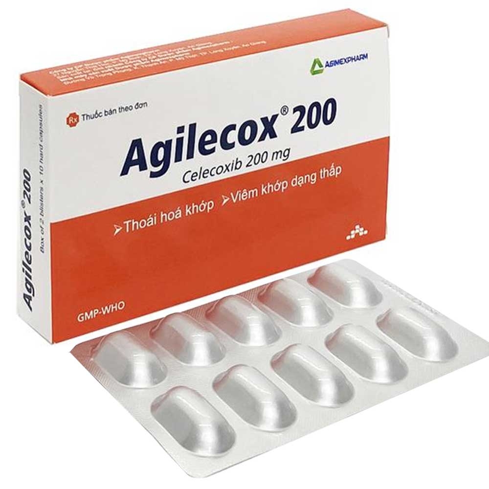 AgileCox 200 - Giải Pháp Quản Lý Dự Án Hiệu Quả Nhất