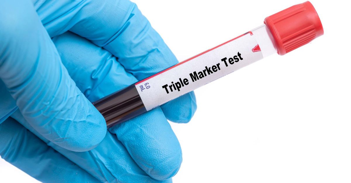 18 tuần có xét nghiệm Triple test được không?