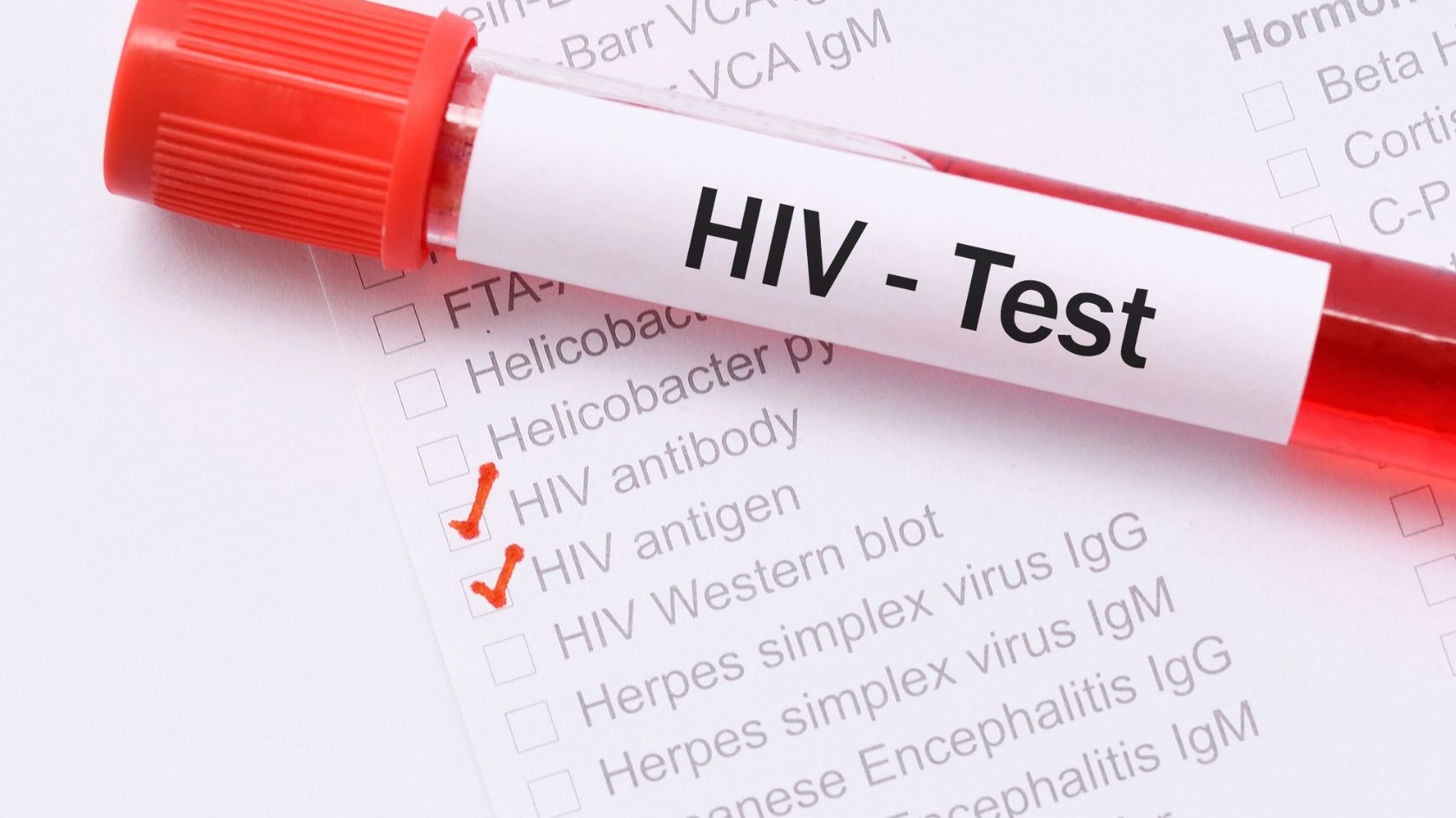 1 tháng xét nghiệm HIV có chính xác không?