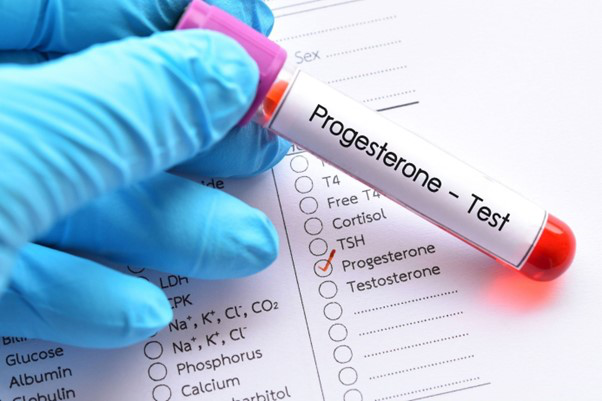 Xét nghiệm progesterone là gì? Tại sao cần làm xét nghiệm progesterone?+1