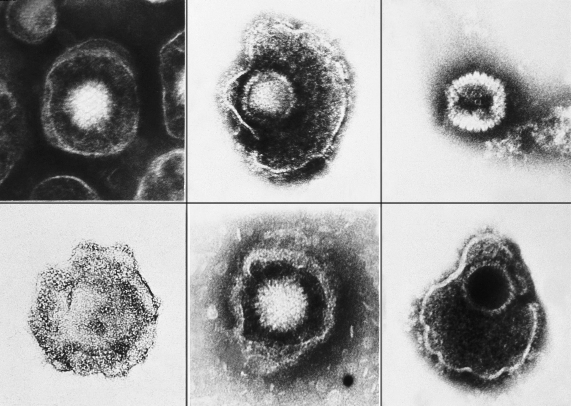 Có những yếu tố nào có thể gia tăng nguy cơ mắc bệnh herpes zoster?
