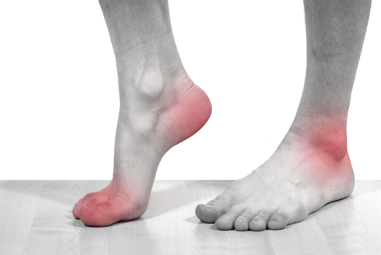 Trẻ em có thể mắc phải đau bàn chân không?

