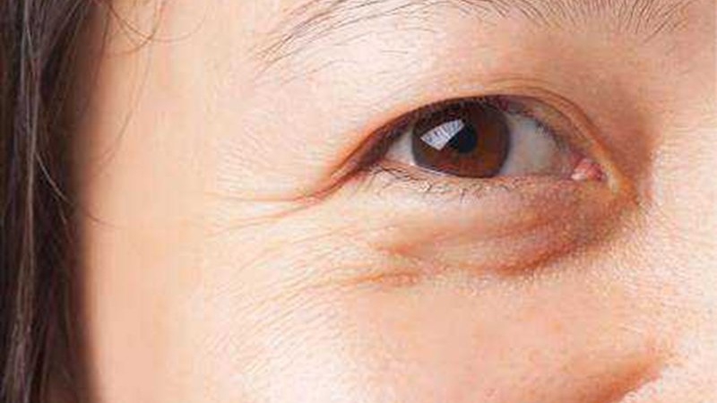 Tại sao mát xa mắt có thể giúp trị sụp mí?
