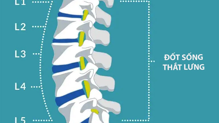 Dị tật gai đôi cột sống L5 là gì? Phát hiện và điều trị như thế nào?