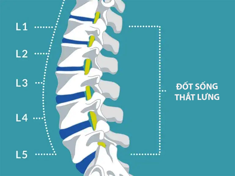 Bài Văn Mẫu 5: Lợi Ích Của Vật Lý Trị Liệu Trong Điều Trị Gai Cột Sống L5