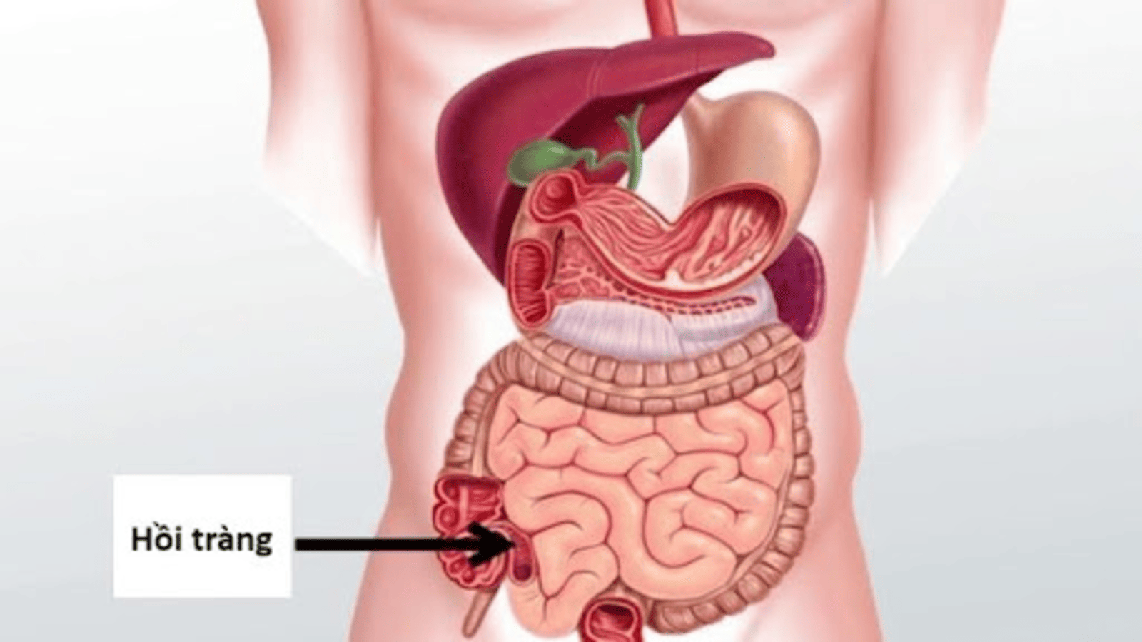 Hồi tràng là gì? Các bệnh lý hồi tràng thường gặp