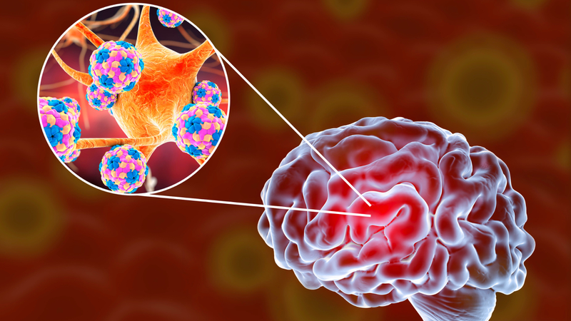 Nhiễm nấm Histoplasmosis: Dấu hiệu và điều trị 4