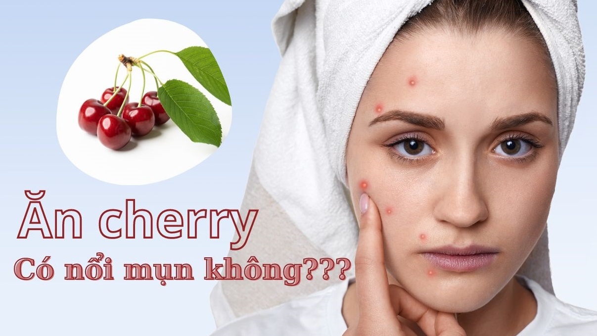 Ăn cherry có nổi mụn không? Cần lưu ý gì khi ăn cherry?