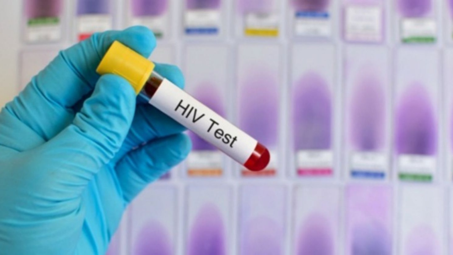 Cách xác định kết quả xét nghiệm anti-HIV là như thế nào?
