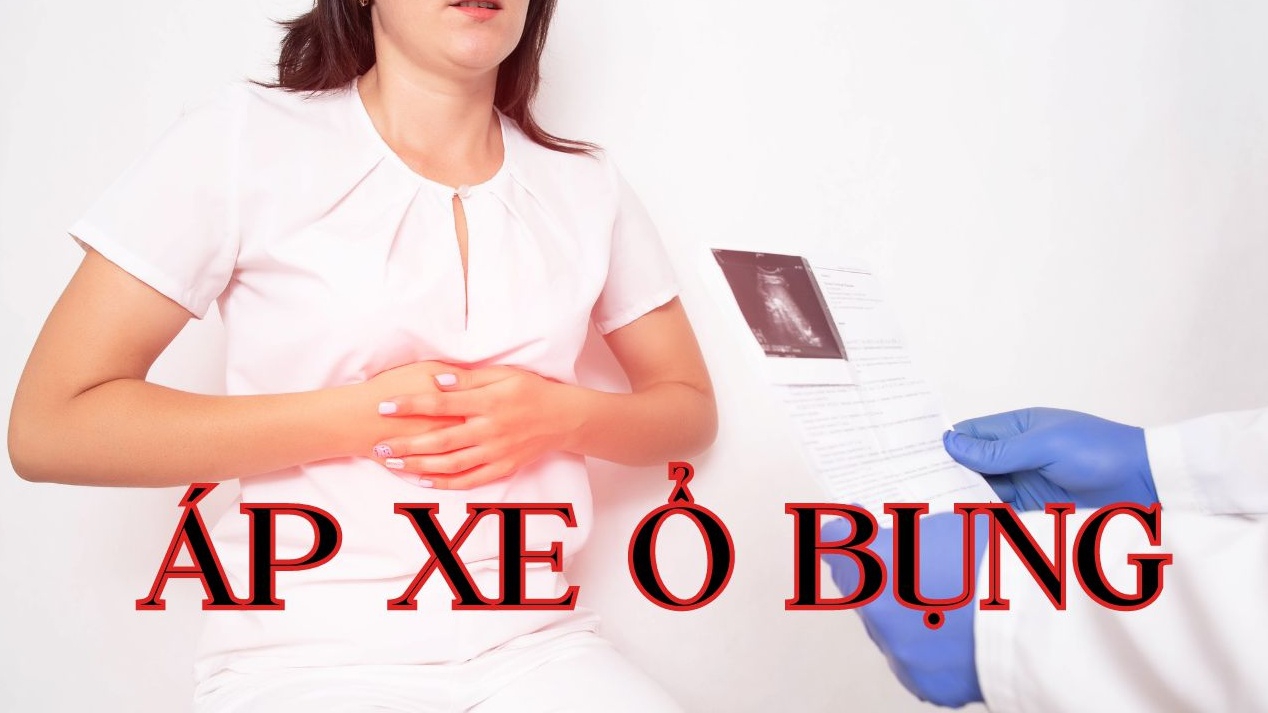 Áp xe ổ bụng: Nguyên nhân, triệu chứng, cách điều trị