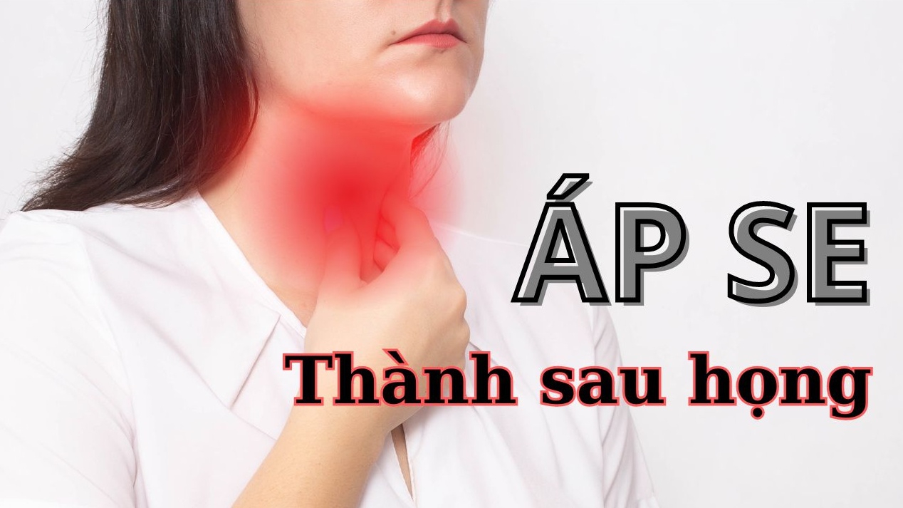 Áp xe thành sau họng và những thông tin người bệnh cần biết