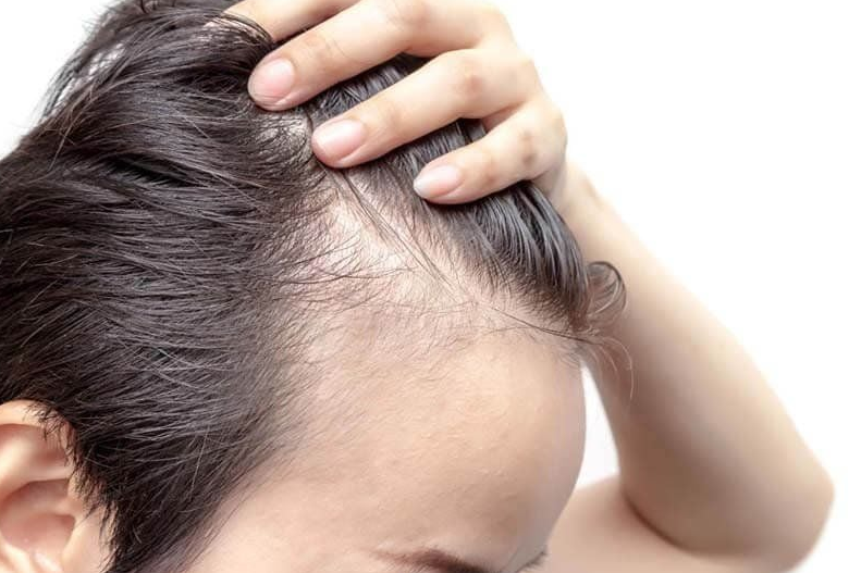 Bí quyết phục hồi nang tóc tự nhiên, an toàn và đơn giản 1