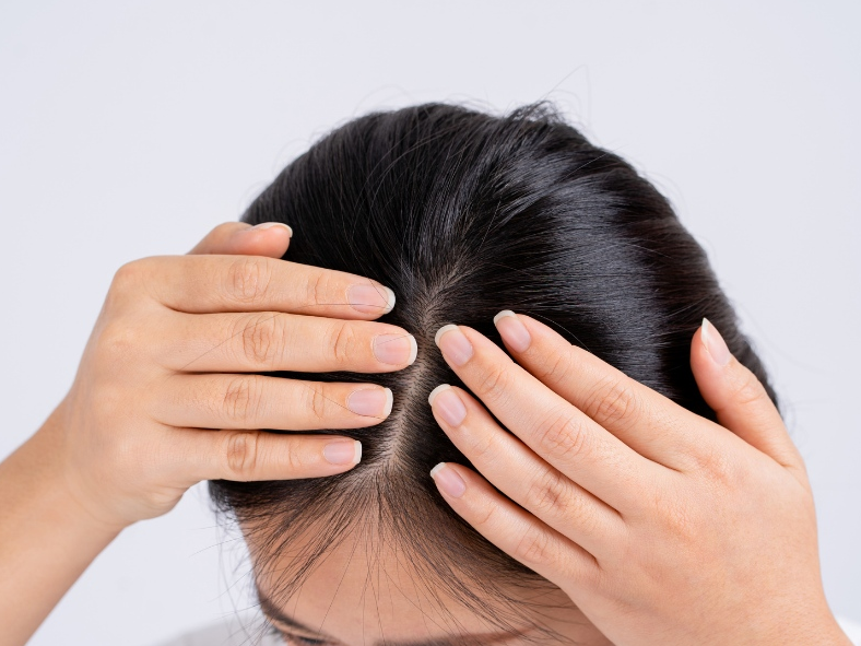 Gội đầu xong bị đau đầu là hiện tượng gì, có nguy hiểm không? 4