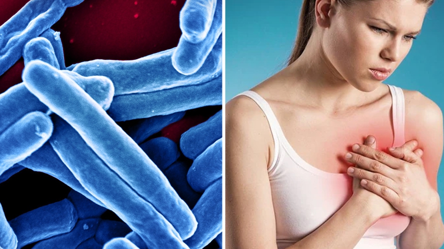 Câu hỏi thường gặp liên quan đến bệnh lao vú