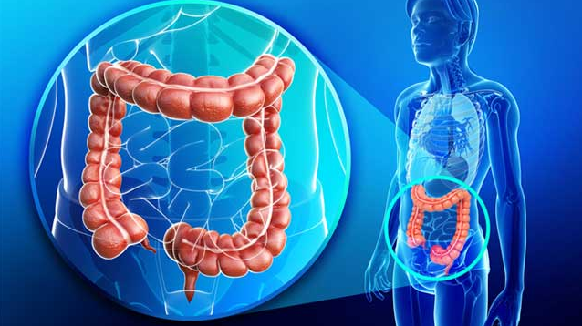 Mổ đại tràng​ và những biến chứng sau mổ cần lưu ý 3