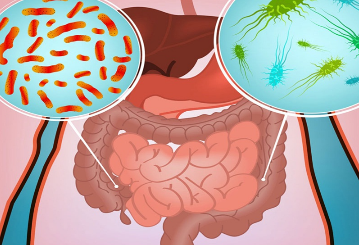 Nhiễm khuẩn đường ruột ở người lớn: Cách chăm sóc và điều trị 1