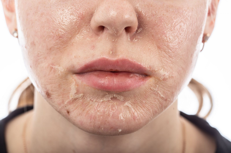 Serum phục hồi da có tác dụng gì? Ai nên dùng serum phục hồi da? 4