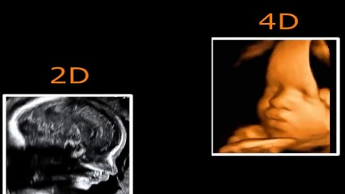 Siêu âm 2D và 4D cái nào chính xác hơn? Siêu âm 2D và 4D khác nhau thế nào?