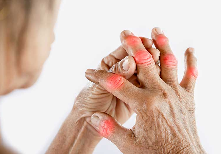 Tại sao một số người không ăn được cua ghẹ​? Làm sao khắc phục? 2