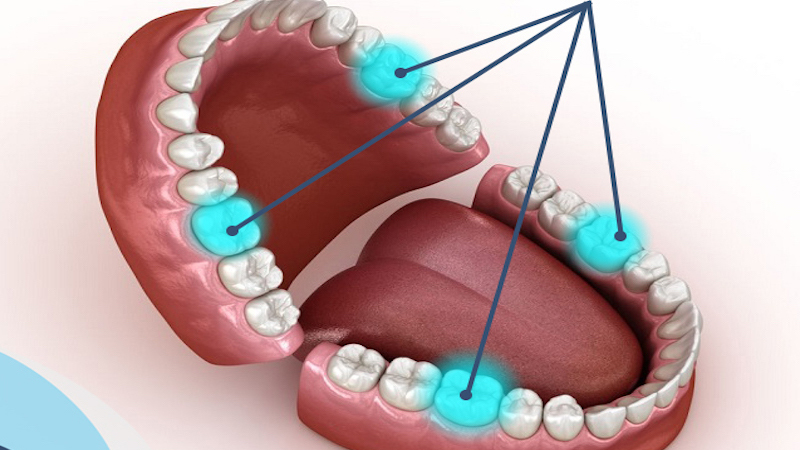 Bạn biết gì về răng số 6? 1