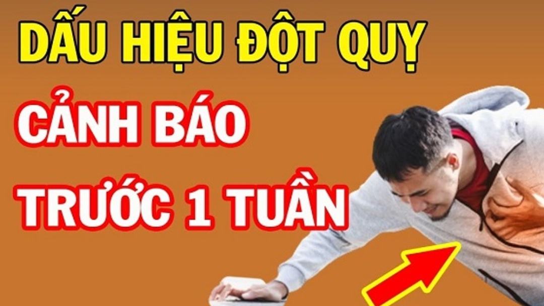 Bật mí 5 dấu hiệu đột quỵ trước 1 tuần không phải ai cũng biết