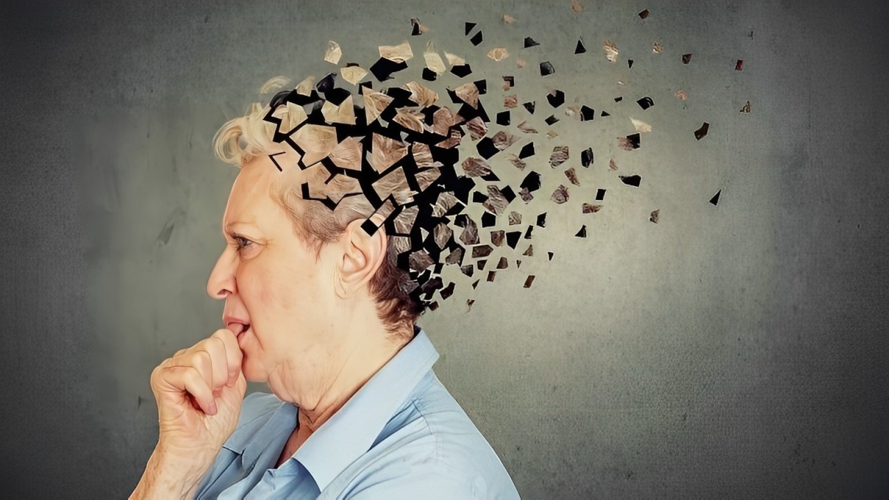 Bệnh Alzheimer có chữa được không? Các phương pháp điều trị hiện nay