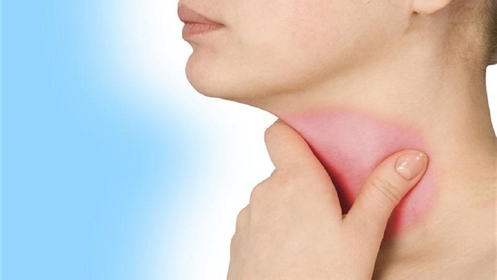Bệnh bướu cổ có lây qua đường hô hấp chỉ xảy ra trong trường hợp nào và có những dấu hiệu như thế nào?
