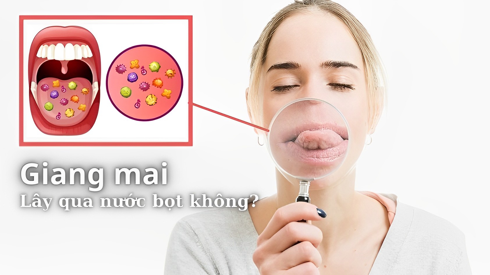 Bệnh giang mai có lây qua nước bọt không?