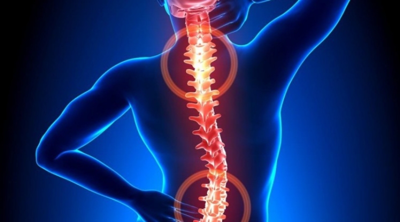 Bệnh rễ thần kinh thắt lưng: Nguyên nhân, triệu chứng và cách khắc phục 4